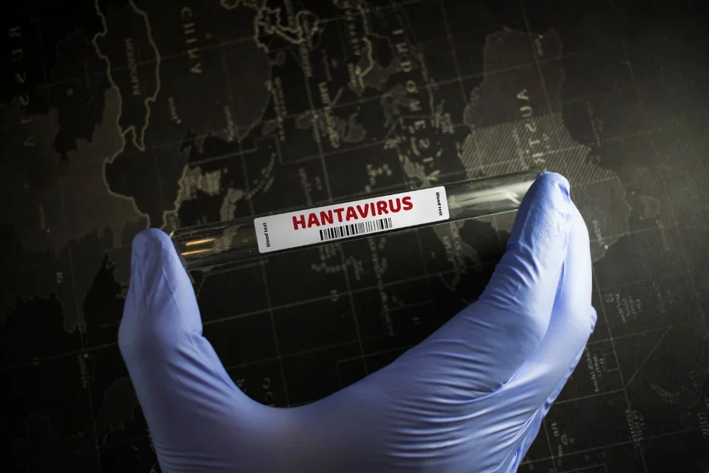 Hantavirus Tersebar di 9 Provinsi, Jabar 5 Kasus dan Banten 1 Kasus