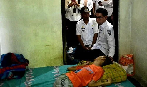 Wakil Bupati Sumedang M Fajar Aldila melihat langsung kondisi Kurniawan.Ist