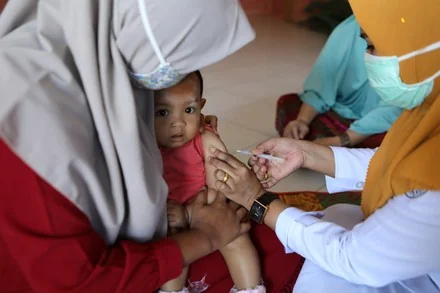 Status KLB, 3 Balita di Cirebon Meninggal karena Campak
